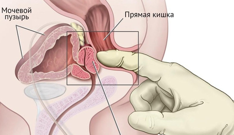 как проверить тонкий кишечник